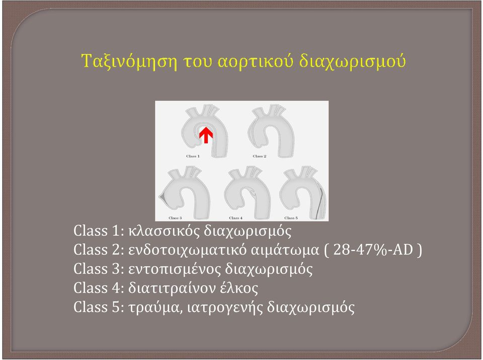 3: εντοπισμένος διαχωρισμός Class 4: