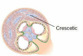 Fokálna glomerulonefritída. Pri týchto glomerulonefritídach je postihnutých menej ako polovica glomerulov v obličke, patrí tu napríklad fokálne segmentálna glomerulonefritída.