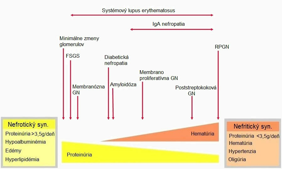 hypertonického interstícia. Výsledok je, že pacient má edémy. Proti hypoproteinémii sa pečeň bráni tak, že začne vo väčšej miere syntetizovať proteíny a lipoproteíny.
