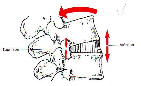 Μεσοσπονδύλιοι δίσκοι 3 Η κάμψη, έκταση και η πλάγια κάμψη της σπονδυλικής στήλης δημιουργούν συμπιεστική επιβάρυνση στη μια πλευρά των μεσοσπονδύλιων