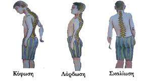 Η λανθασμένη στάση του σώματος: Μπορεί να προκαλέσει πολλά προβλήματα στη πλάτη, στον αυχένα και στους ώμους με