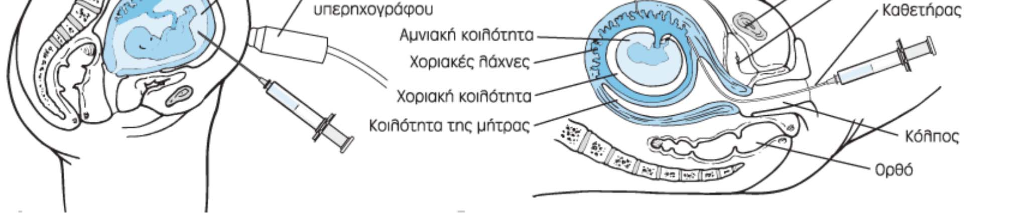 Κεφάλαιο 15 (Ιατρική