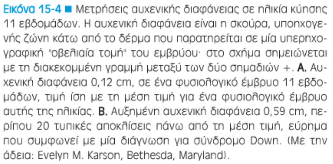Διερεύνηση για σύνδρομο Down (και άλλες ανευπλοειδίες) (1 ο /2 ο τρίμηνο) -70% των παιδιών με αυτοσωμικές τρισωμίες μητέρες <35 ετών όπου δεν παρέχεται παρεμβατικός έλεγχος -οι τιμές της AFP