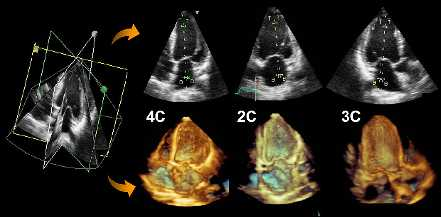 3D+CONTRAST DSE