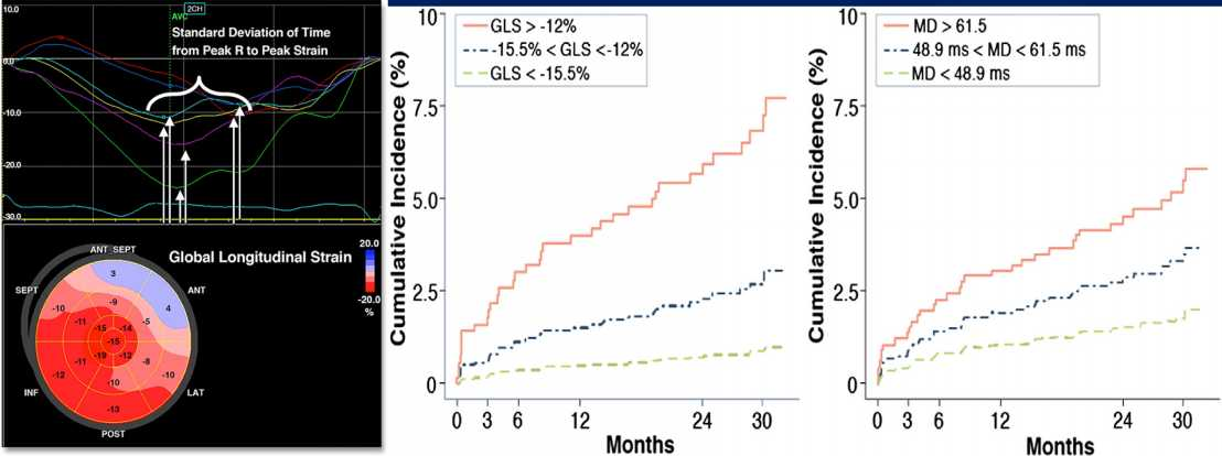 Early Echocardiographic Deformation Analysis for the Prediction of Sudden Cardiac Death and Life-Threatening