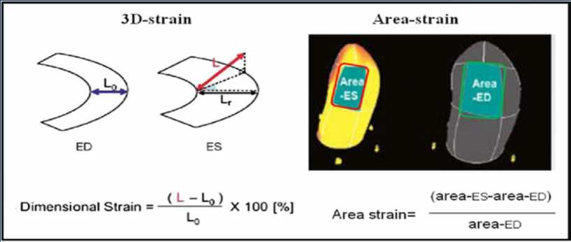 3D speckle tracking allows the quantification of 2 new 3-dimensional indexes: -3-dimensional strain obtained by the sum of radial, circumferential, and longitudinal