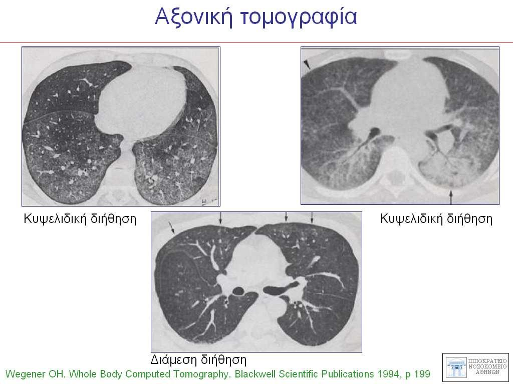 γεωγραφική διαυγαστικότητος