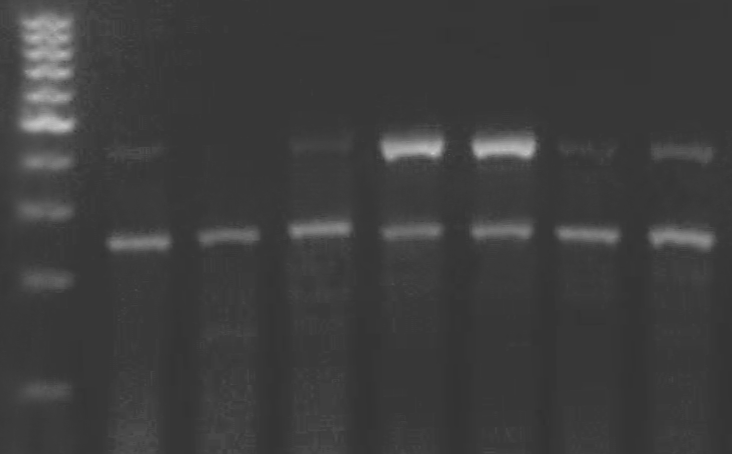 Αποτελέσµατα 100 Β 24h 500bp 400 bp 300 bp 200 bp MMP-1 (428bp) GAPDH (263bp) TGF-β 1 (ng/ml) - 1 10 - - 1 10 IL-1β (ng/ml) - - - 1 10 1 10 Γ 48h 500bp 400bp 300bp 200bp MMP-1 (428bp) GAPDH (263bp)