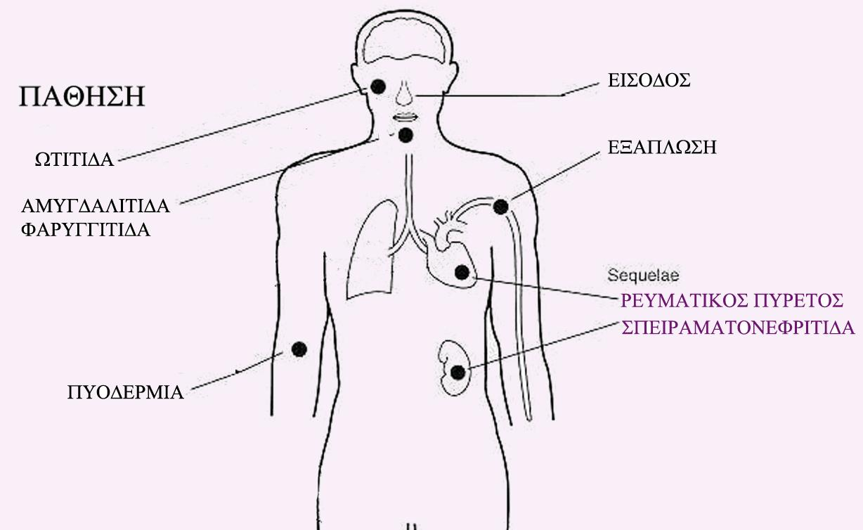 Streptococcus pyogenes (πυογόνος στρεπτόκοκκος) ΠΑΘΗΣΕΙΣ Φαρυγγίτιδα Αμυγδαλίτιδα Ωτίτιδα Πυοδερμία Οστρακιά Ρευματικό πυρετό* Μοριακός μιμητισμός (παραγωγή αντι-μ αντισωμάτων που