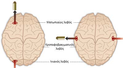 Α. Μηχανισμοί πρόκλησης των ΚΕΚ Διαπεραστικά τραύματα εγκεφάλου (ανοιχτές κρανιοεγκεφαλικές κακώσεις) Τα περισσότερα διαπεραστικά τραύματα εγκεφάλου προκαλούνται από βλήματα (π.χ. σφαίρες, πέτρες, τεμάχια εξοστρακισμένων σφαιρών, ή από άλλα βλήματα).