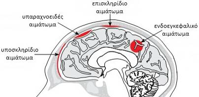 Αιμορραγικοί τραυματισμοί (εξωπαρεκχυματικές - ενδοπαρεκχυματικές βλάβες) Οι μωλωπισμοί στον εγκέφαλο λόγω αιμορραγίας του, συσσωρεύουν αίμα σε συγκεκριμένες περιοχές.