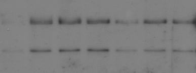 Αποτελέσµατα Επώαση µε E. coli στους 25 ο C Grace FAK Y397: WB G 2 5 10 15 20 30 min 1 2 3 4 5 6 7 FAK: WB Εικόνα 105. Επαγόµενη ενεργοποίηση της FAK από την E. coli στους 25 ο C. Αιµοκύτταρα από το στάδιο περιπλάνησης καλλιεργήθηκαν σε εναιώρηµα και διεγέρθηκαν µε βακτήρια E.
