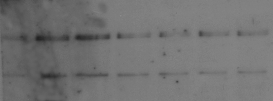 Αποτελέσµατα Grace Επώαση µε E. coli στους 4 ο C FAK Y397: WB G 2 5 10 15 20 30 min FAK: WB 1 2 3 4 5 6 7 Εικόνα 106. Επαγόµενη ενεργοποίηση της FAK από την E. coli στους 4 ο C. Αιµοκύτταρα από το στάδιο περιπλάνησης καλλιεργήθηκαν σε εναιώρηµα και διεγέρθηκαν µε βακτήρια E.
