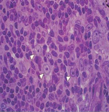 Φλοιός θύμου περιοχή πλούσια σε Τ-λεμφοκύτταρα (σκούρο χρώμα), τα «διπλά-θετικά» πεθαίνουν από απόπτωση σε 3 μέρες χωρίς σήμα επιβίωσης, διαφορετικά εξελίσσονται σε