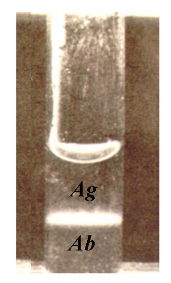 ΔΟΚΙΜΗ ΔΑΚΤΥΛΙΟΥ (RING TEST) Διαδικασία διάλυμα αντισώματος στον πυθμένα του λεπτού σωλήνα διάλυμα