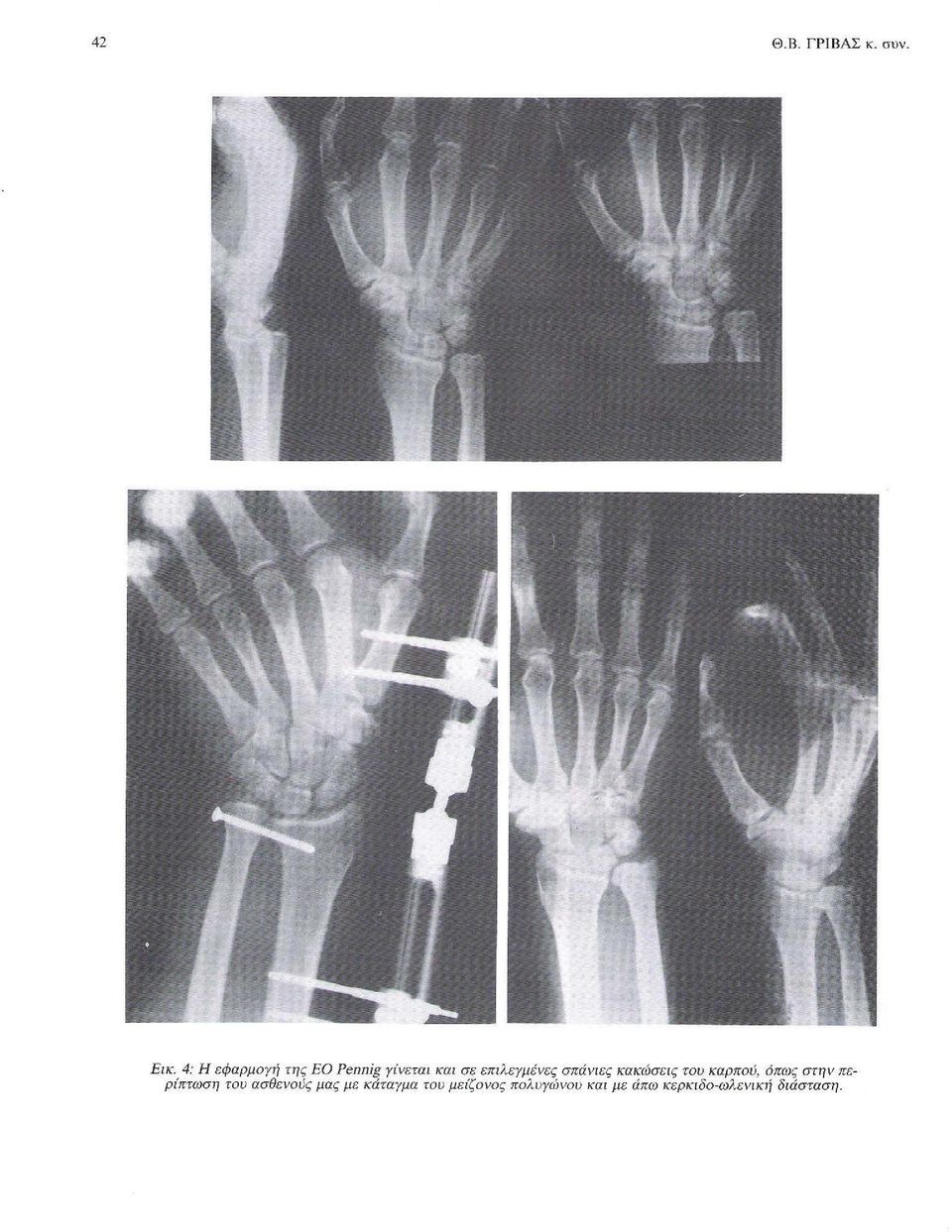 σπάνιες κακώσεις του καρπού, όπως στην περίπτωση του