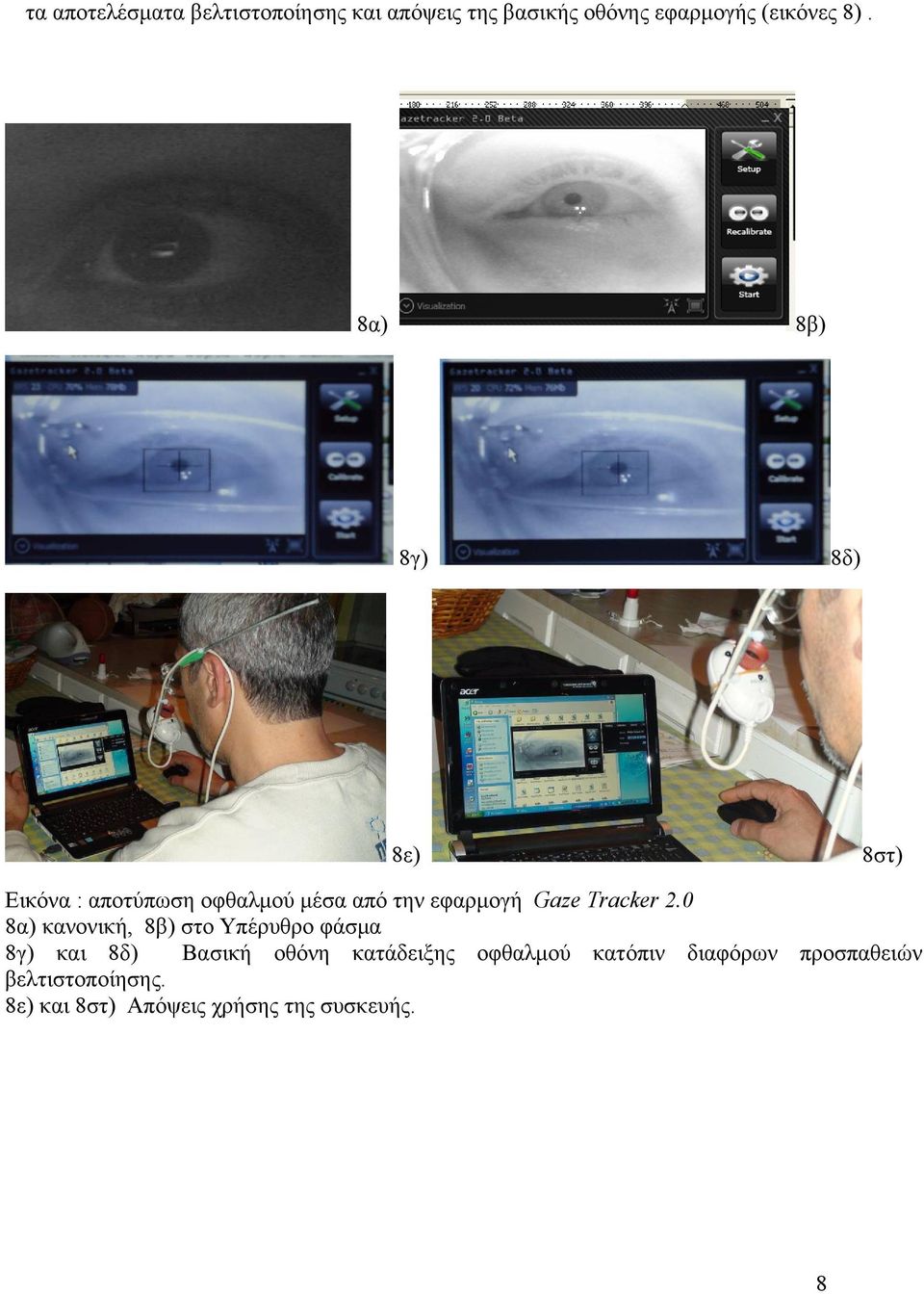 2.0 8α) κανονική, 8β) στο Υπέρυθρο φάσμα 8γ) και 8δ) Βασική οθόνη κατάδειξης οφθαλμού