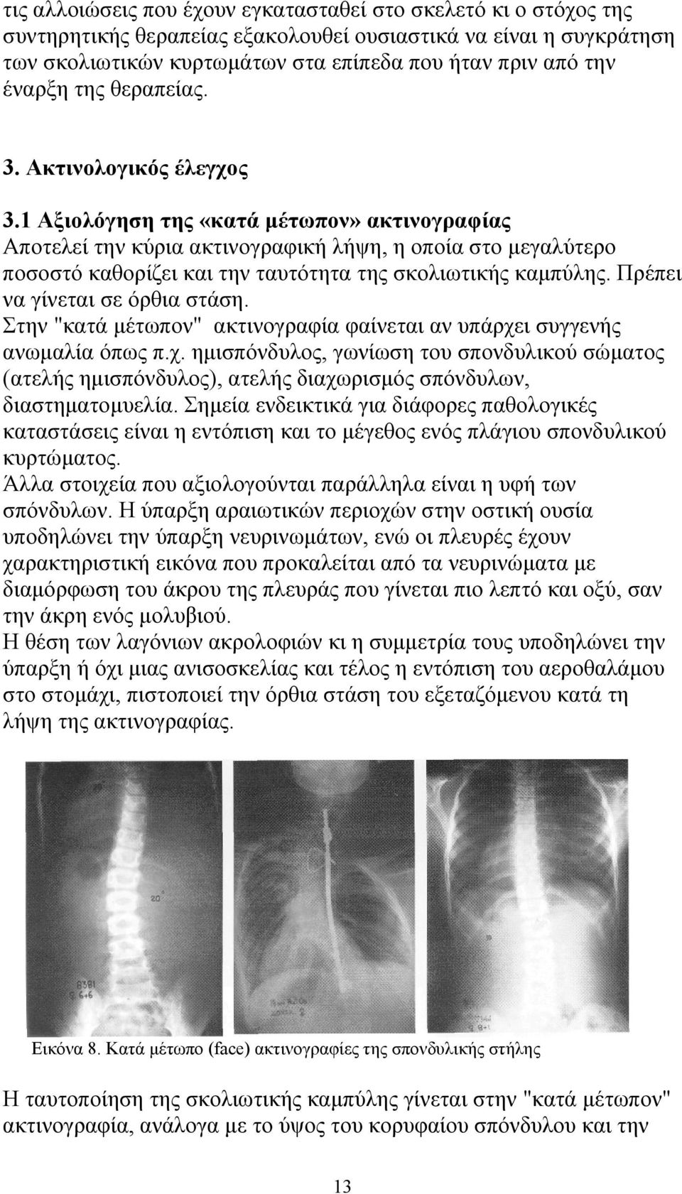 1 Αξιολόγηση της «κατά μέτωπον» ακτινογραφίας Αποτελεί την κύρια ακτινογραφική λήψη, η οποία στο μεγαλύτερο ποσοστό καθορίζει και την ταυτότητα της σκολιωτικής καμπύλης.