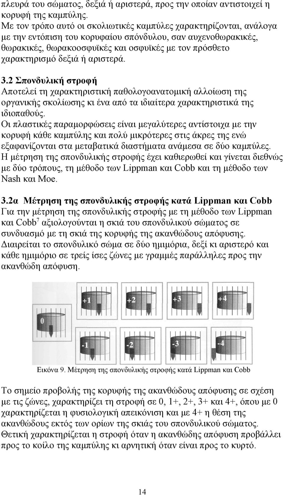 δεξιά ή αριστερά. 3.2 Σπονδυλική στροφή Αποτελεί τη χαρακτηριστική παθολογοανατομική αλλοίωση της οργανικής σκολίωσης κι ένα από τα ιδιαίτερα χαρακτηριστικά της ιδιοπαθούς.