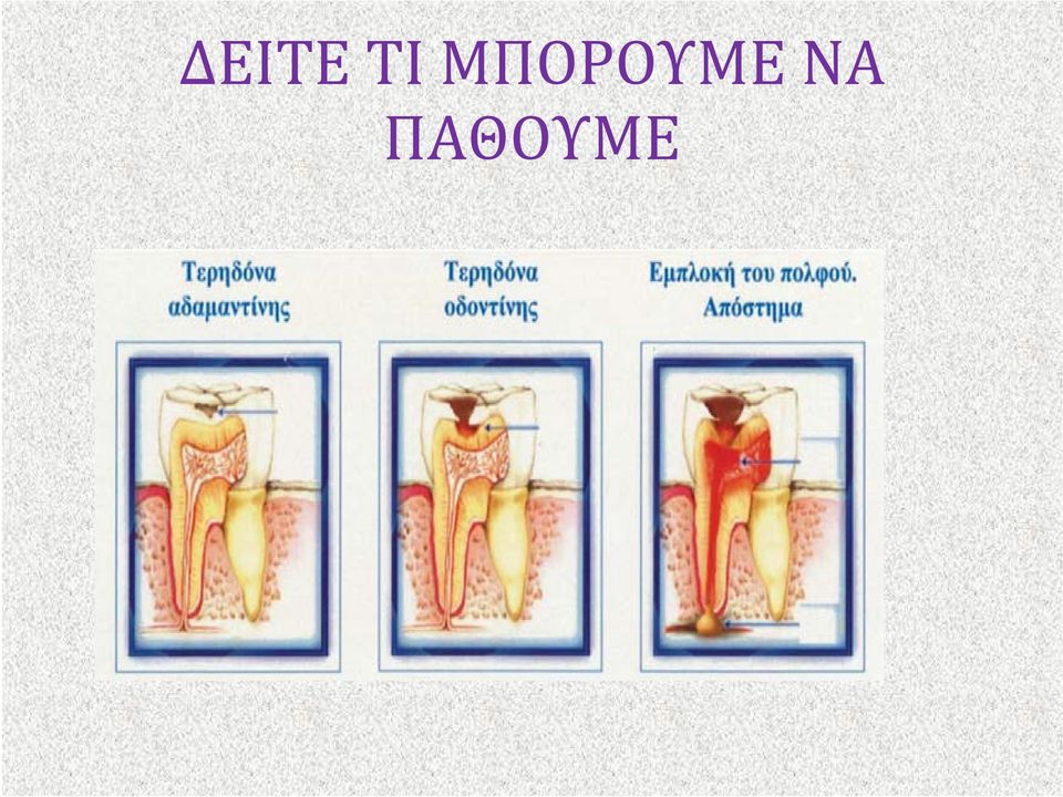 ΝΑ