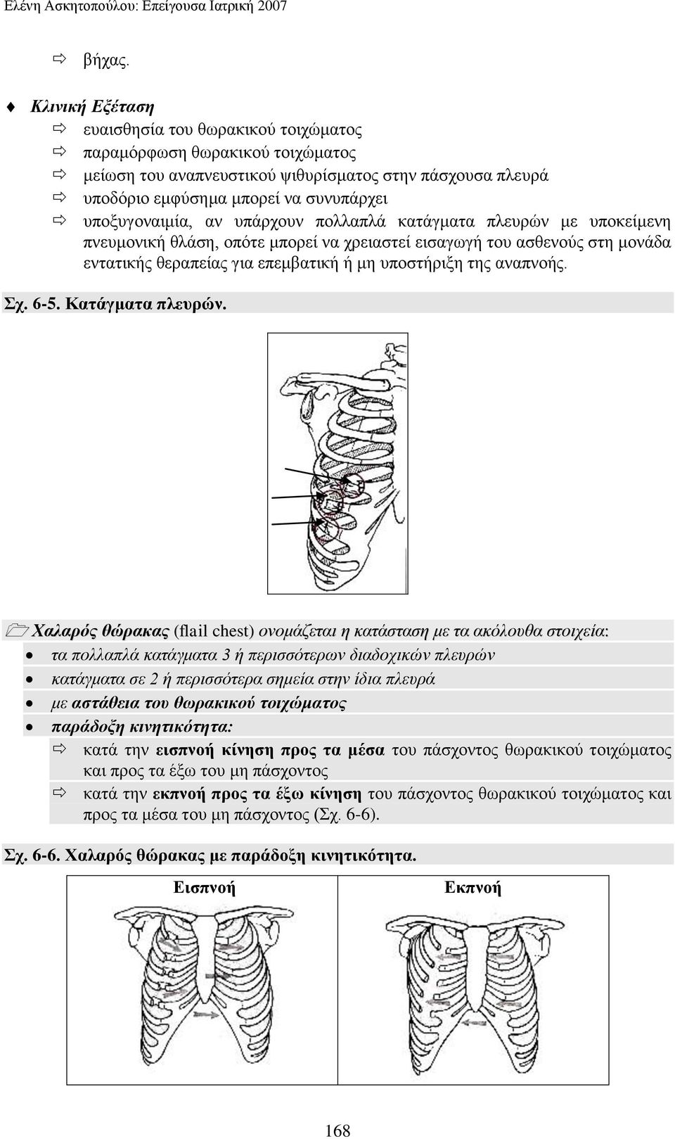 αλ ππάξρνπλ πνιιαπιά θαηάγκαηα πιεπξώλ κε ππνθείκελε πλεπκνληθή ζιάζε, νπόηε κπνξεί λα ρξεηαζηεί εηζαγσγή ηνπ αζζελνύο ζηε κνλάδα εληαηηθήο ζεξαπείαο γηα επεκβαηηθή ή κε ππνζηήξημε ηεο αλαπλνήο. σ.