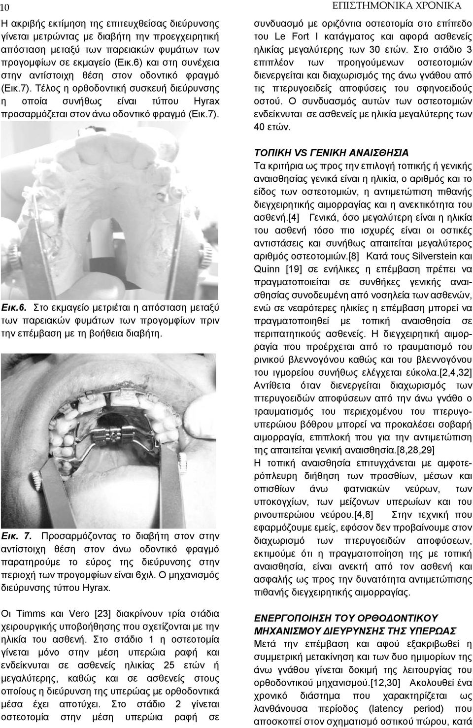 Εικ. 7. Προσαρμόζοντας το διαβήτη στον στην αντίστοιχη θέση στον άνω οδοντικό φραγμό παρατηρούμε το εύρος της διεύρυνσης στην περιοχή των προγομφίων είναι 6χιλ. Ο μηχανισμός διεύρυνσης τύπου Hyrax.