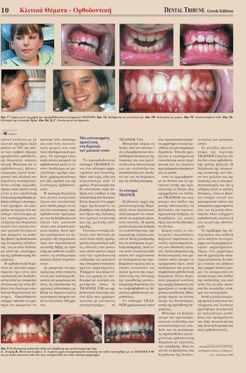 DT σελίδα 8 κίλουν ανάλογα µε τα κλινικά κριτήρια αλλά µάλλον το 70% και πλέον των εφήβων σήµερα χρειάζονται ορθοδοντική θεραπεία κάποια στιγµή.