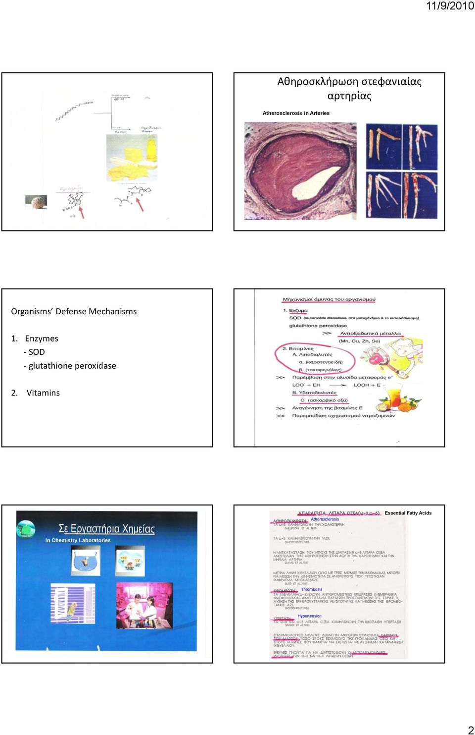 Enzymes SOD glutathione peroxidase 2.