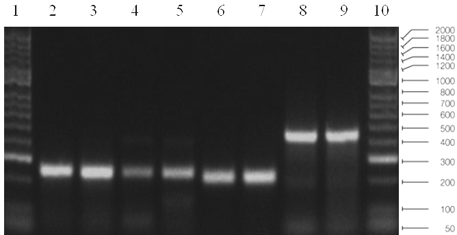 ολικό RNA και πραγματοποιήθηκε αντίστροφη μεταγραφή και αλυσιδωτή αντίδραση πολυμεράσης σε πραγματικό χρόνο.