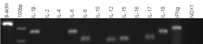 από in vitro καλλιέργειες κυττάρων Sertoli. Tα αποτελέσµατα των RT-PCR αναλύσεων απεικονίζονται στην Εικόνα 18. Εικόνα 18. Έκφραση των κυτταροκινών στα κύτταρα Sertoli, µέσω της RT-PCR.