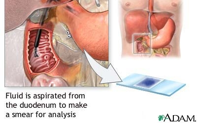 Limfaticele: ajung la noduri limfatice hepatice şi celiace.