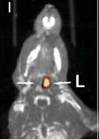 Imaging Apoptosis with 99mTc-annexinA5 Death of both VSMCs and macrophages is a characteristic feature of unstable plaques.