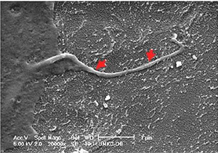 Mechanosensation and mechanotransduction Μζςω των δενδριτικϊν προςεκβολϊν, του ςϊματοσ των κυττάρων, αλλά κυρίωσ τθσ ροισ διάμεςου υγροφ (fluid flow hypothesis) υμπίεςθ από φόρτιςθ και