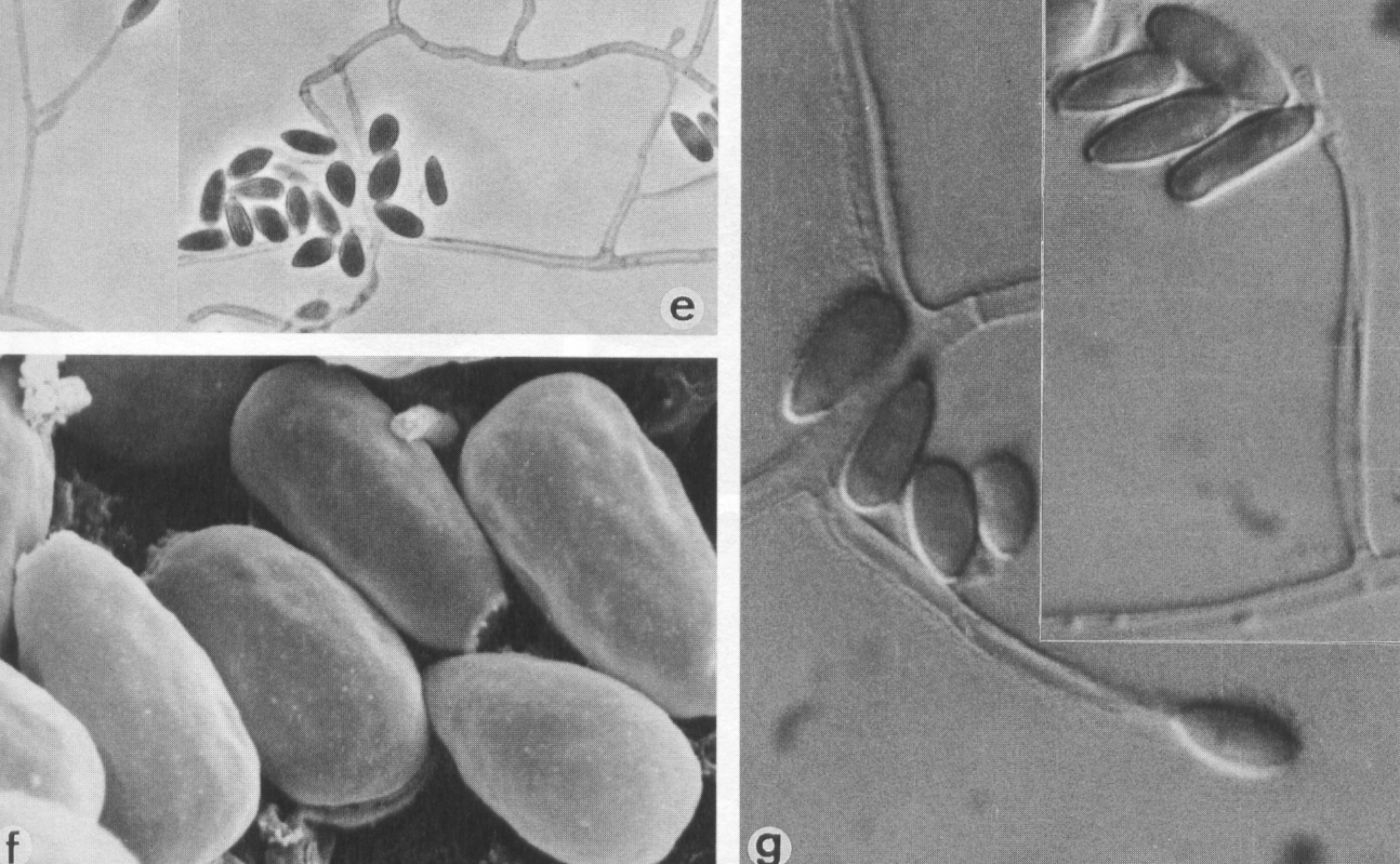 Pseudallescheria boydii (a, b, c, d)