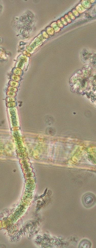 Το παράδειγμα της λίμνης Κορώνειας Koronia 2010: Spirogyra,