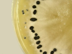 Βιολογικό υλικό: Μύκητες Botrytis cinerea Colletotrichum coccodes