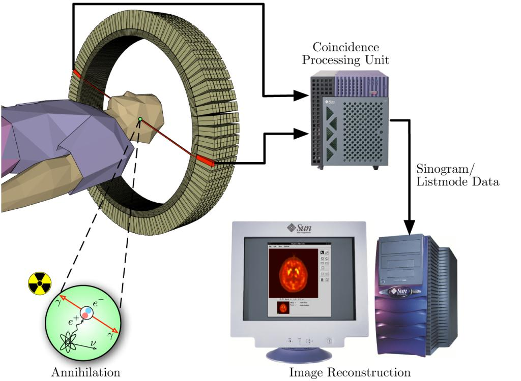 PET(positron emission tomography) στηρίζεται στην καταγραφή της αυξημένης κατανάλωσης γλυκόζης στις εγκεφαλικές περιοχές που είναι ενεργές κατά τη διάρκεια ορισμένου τύπου επεξεργασίας πληροφοριών.