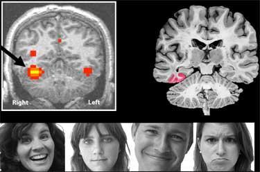 The above image (left in the picture) shows the location in the brain that is responsive to faces in typical individuals.