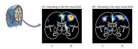 In confirmation of the impressions derived from neurological patients with parietal lobe damage, the right parietal cortex of normal subjects is highly active during tasks requiring attention.