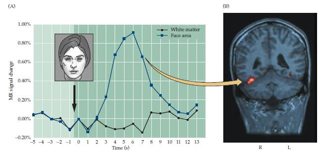 Functional brain imaging of temporal lobe during face recognition. (A) Face stimulus presented to a normal subject at time indicated by arrow.