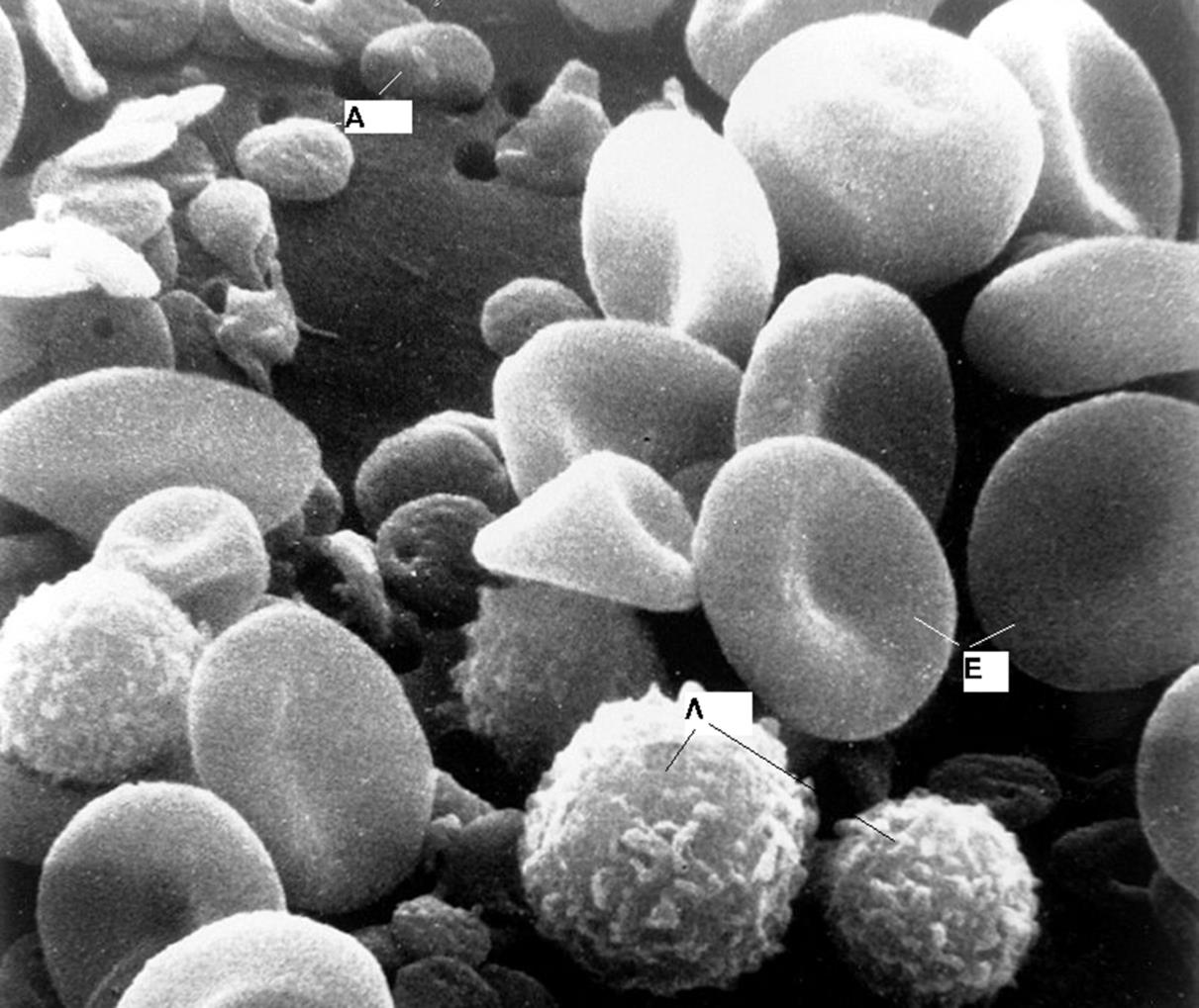 Τα αιμοπετάλια είναι κυτταρικά θραύσματα, μήκους 2-4 μm, τα οποία αποτελούν λιγότερο από το 1% του πλήρους αίματος. Αριθμούν 250.000-400.000 ανά κυβικό χιλιοστό αίματος.