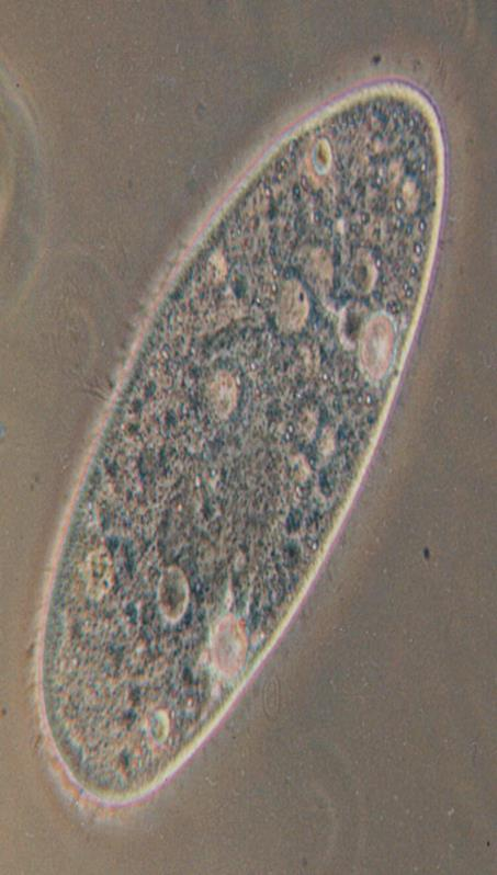 Εικόνα 2.11. Η Arcella ζει σε ένα προστατευτικό περίβλημα. Παρατηρήστε τα ψευδοπόδια στη μία άκρη του κυττάρου.