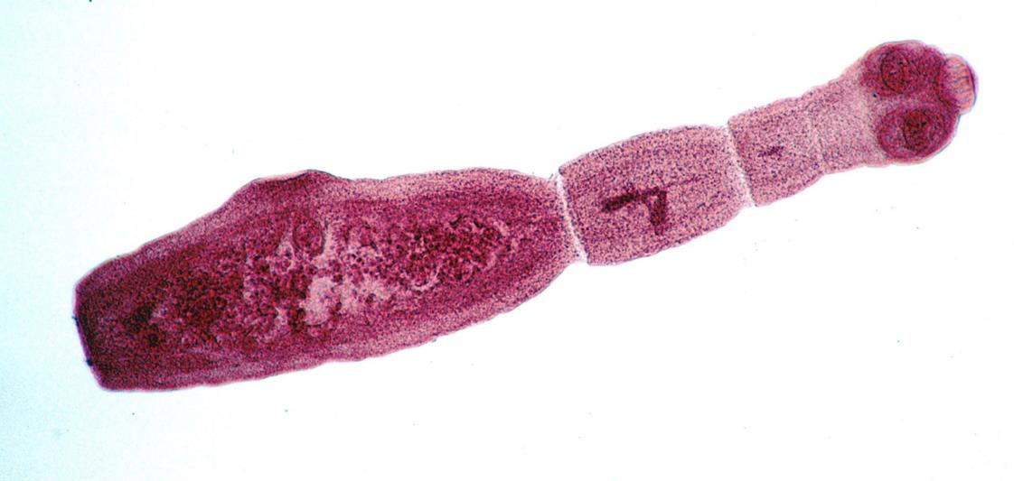 5.1.2.1.γ. Echinococcus granulosus (εχινόκοκκος του σκύλου) Ο εχινόκοκκος γενικότερα συγκαταλέγεται ανάμεσα στα σημαντικότερα παθογόνα παράσιτα του ανθρώπου (Μπαμπινιωτάκης, 1991).