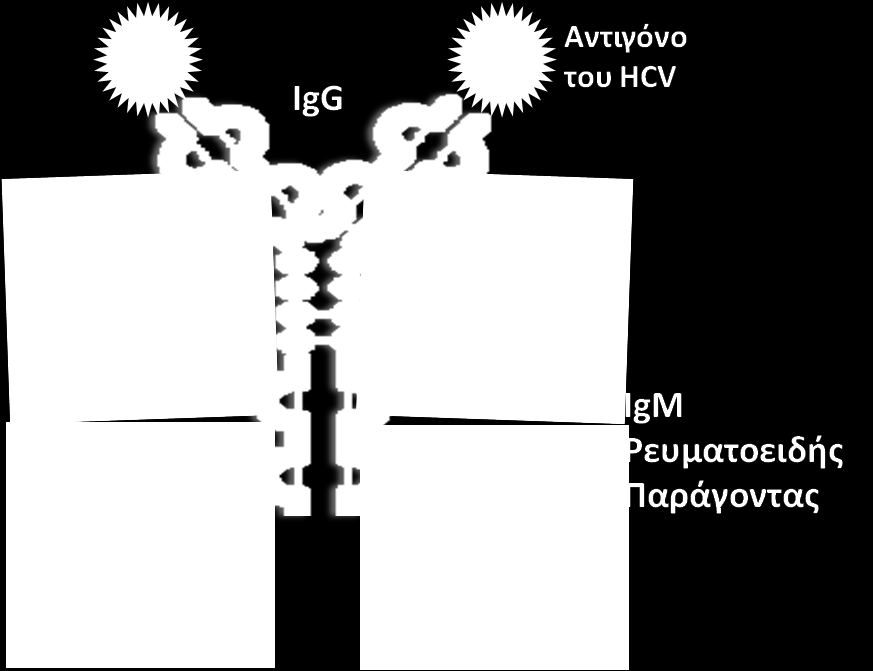 Εικόνα 34. Έμμεση διέγερση της στερεότυπης IGHV4-59/IGKV3-20 ανοσοσφαιρίνης με δράση ρευματοειδούς παράγοντα. Figure 34.