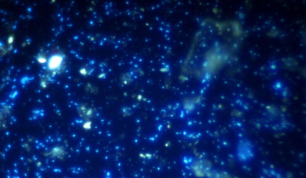 Πλαγκτικά Τροφικά Πλέγματα Βακτηριοπλαγκτό Τα ετερότροφα βακτήρια του πλαγκτού (στη μικροφωτογραφία) άφθονα όπως τ αστέρια στους γαλαξίες