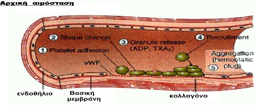ΕΙΚΟΝΑ 2 : Αρχική αιµόσταση προσκόλληση των αιµοπεταλίων (1), τα οποία αλλάζουν σχήµα (2) και εκλύουν κοκκία (3), ακολουθεί η συγκόλληση (4) και τελικά η συσσώρευση των αιµοπεταλίων (5) µε αποτέλεσµα