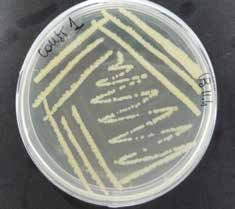 ΑΡΙΣΤΕΙΑ_ BIOREMEDIATOMICS Έρευνα & Ανάπτυξη / Μάρτιος 2015 6 Η μικροβιακή αποτοξικοποίηση των γεωργικών φαρμάκων που χρησιμοποιούνται στα συσκευαστήρια φρούτων: χρησιμοποιώντας ομικές προσεγγίσεις