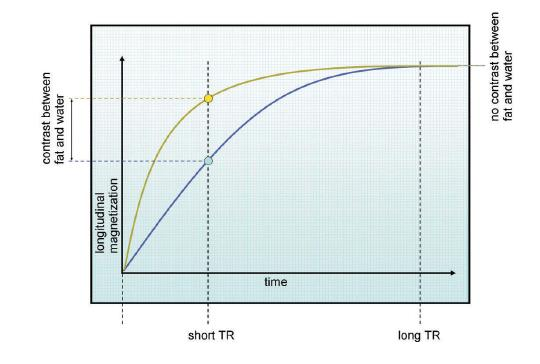 Τ1 Αντίθεση Ο χρόνος Τ1 του λίπους είναι μικρότερος από οτι αυτός του νερού, επομένως το διάνυσμα του λίπους ευθυγραμμίζεται γρηγορότερα με το πεδίο Βο, και αρα έχει και διαμήκη συνιστώσα μαγνητισμού