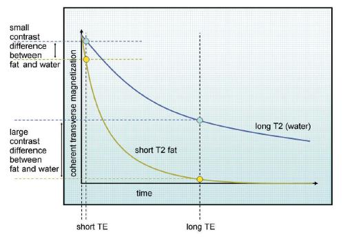 Τ2-weighted εικόνα Για να παραχθεί μια T2 - weighted εικόνα μέσω της ακολουθίας spin-echo, πρέπει να χρησιμοποιηθεί μεγάλο TR και μεγάλο ΤΕ έτσι ώστε και το νερό και το λίπος να έχουν χρόνο να