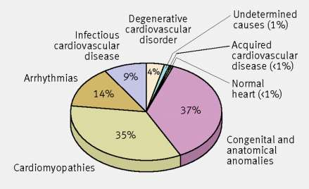 Causes of sudden cardiac death in young athletes the most common mechanism of SCD during sports activity is an abrupt